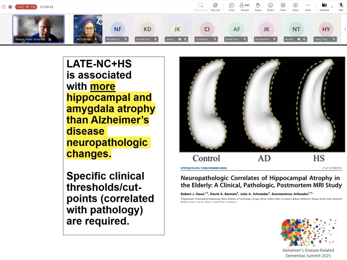 Dr. Pete Nelson presenting at the ADRD Summit 2025 our seminal 2011 paper showing that LATE-NC &amp; hippocampal sclerosis (HS) are associated with more hippocampal atrophy than Alzheimer's pathology <a href="/IITEngineering/">Armour College of Engineering at Illinois Tech</a> <a href="/rushalzheimers/">Rush Alzheimer's Disease Center</a> <a href="/NIH_NINDS/">NINDS</a> <a href="/NIHAging/">The National Institute on Aging (NIA)</a>