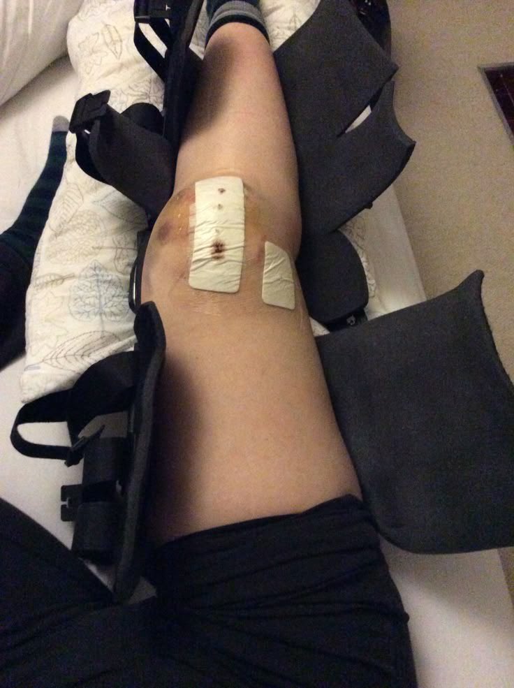 Injured Proof