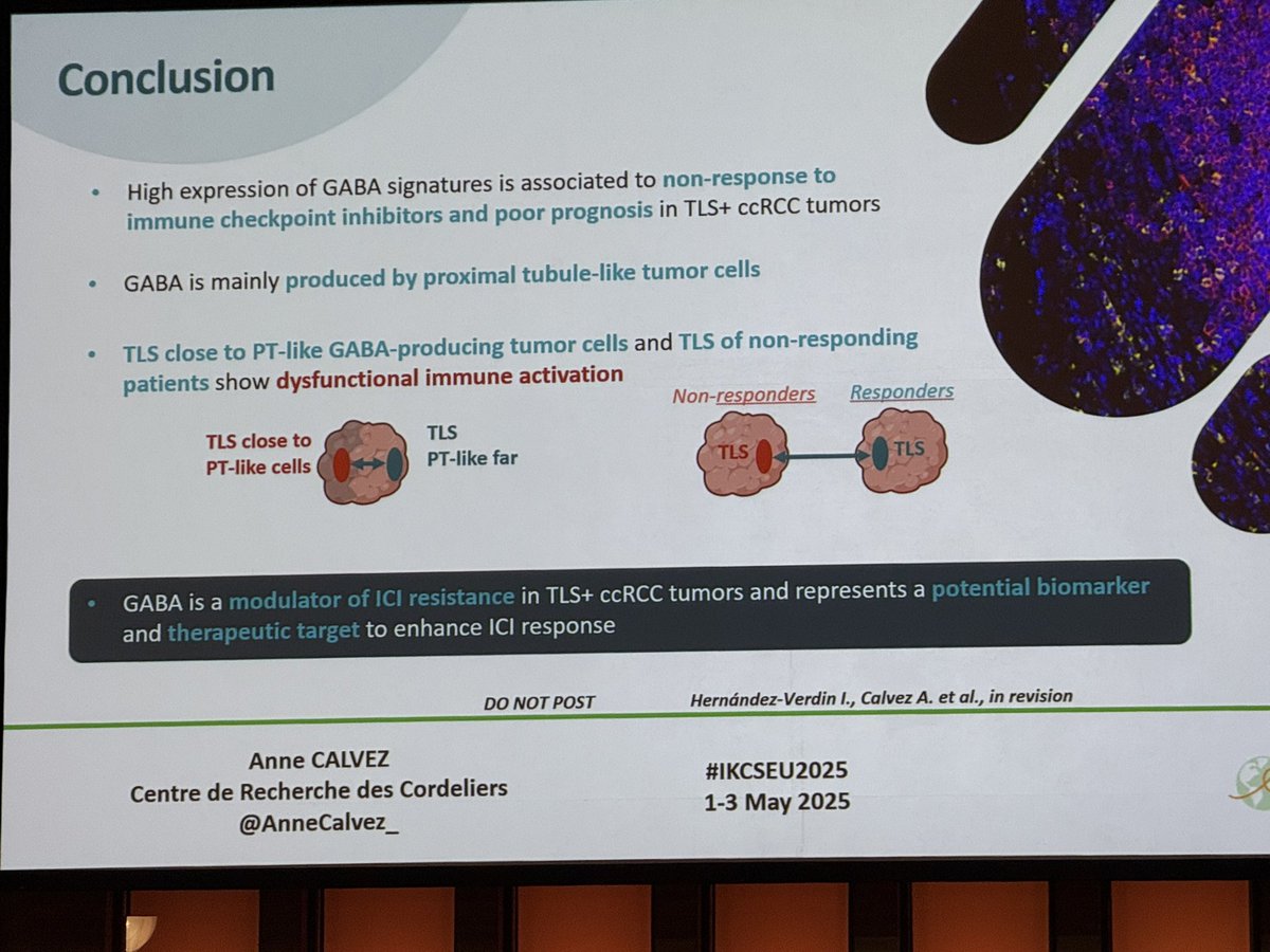 Marc-Olivier Timsit, MD, PhD 🎗️ (@urologieparis) on Twitter photo Thanks <a href="/AnneCalvez_/">Anne Calvez</a> for sharing your great work from <a href="/Inserm/">Inserm</a> Cordeliers - <a href="/OudardStephane/">Stéphane Oudard</a> on TME and GABA in RCC !
We meet every week at tumor board but I had to travel to Amsterdam #IKCSEU25 to better understand your research 🤣 Thanks <a href="/AnneCalvez_/">Anne Calvez</a> for sharing your great work from <a href="/Inserm/">Inserm</a> Cordeliers - <a href="/OudardStephane/">Stéphane Oudard</a> on TME and GABA in RCC !
We meet every week at tumor board but I had to travel to Amsterdam #IKCSEU25 to better understand your research 🤣