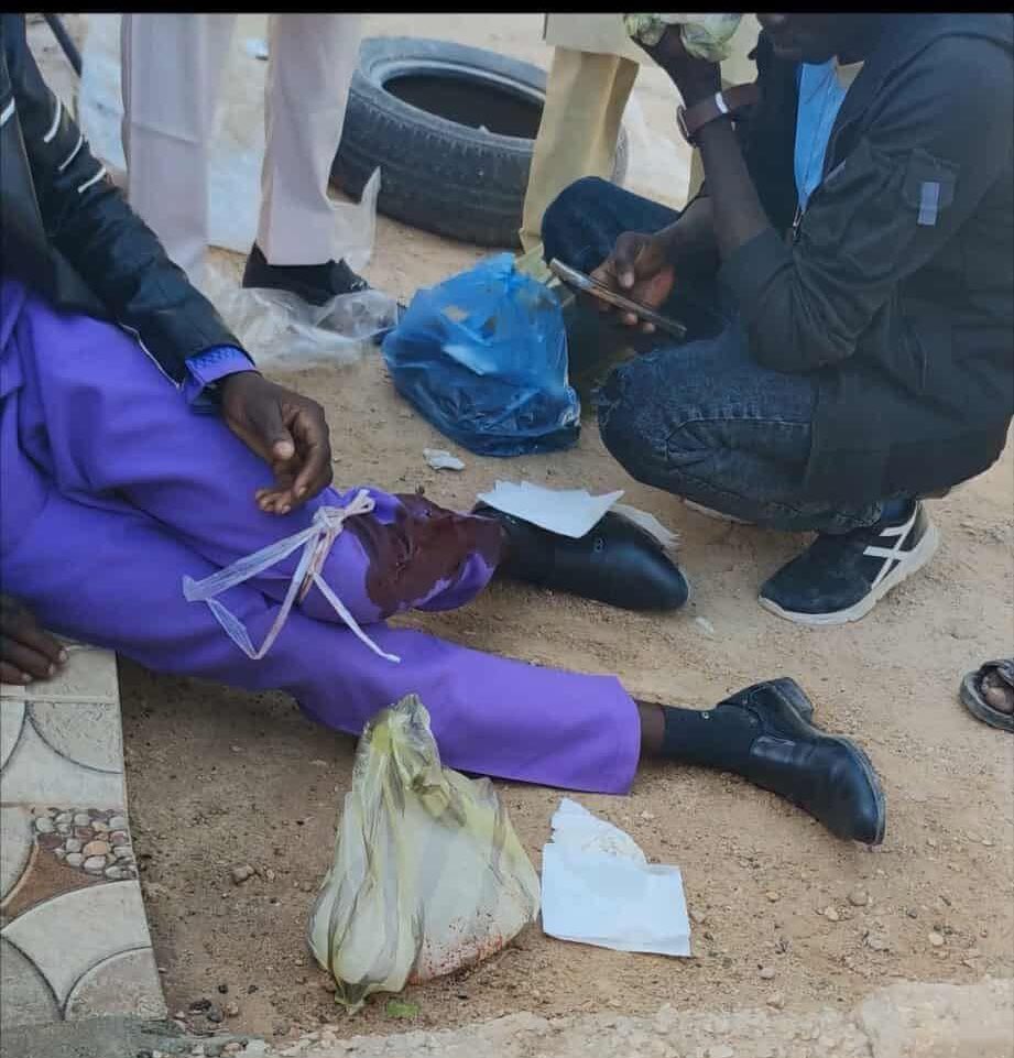 An armed group in the city of Sabratha attacked two Sudanese workers. They struck a Sudanese man in the head with a pistol butt. At the same time, they shot another Sudanese man in the foot near the security school headquarters. No one intervened to offer assistance.