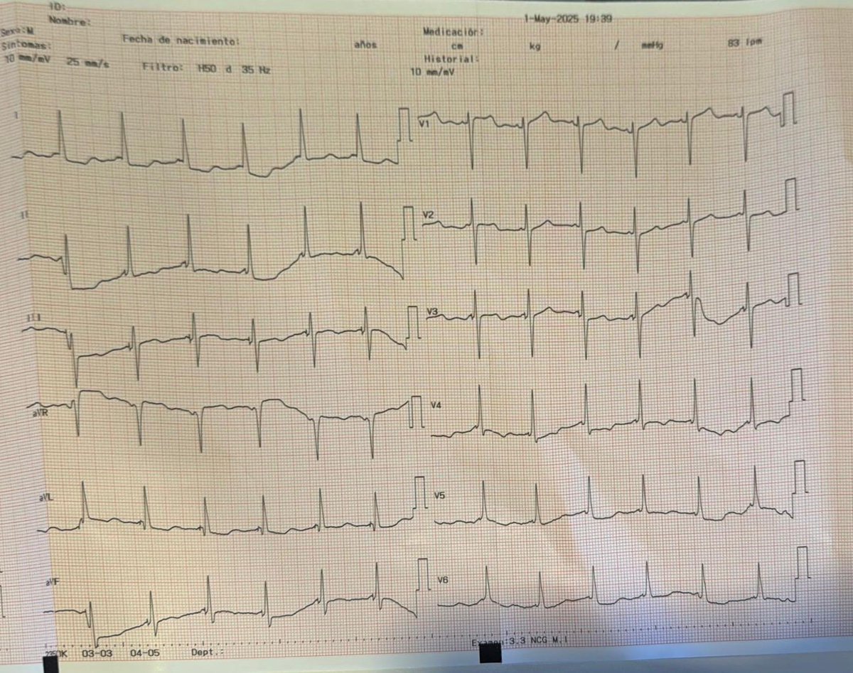 Final ECG