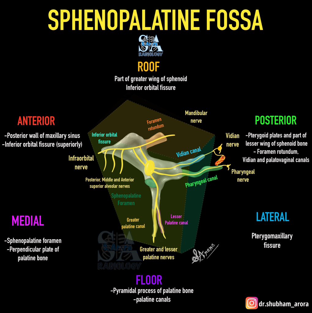 Dr_S_Arora's tweet image. Slide on anatomy of Sphenopalatine fossa.
#MedX #radiology #radiologyillustration