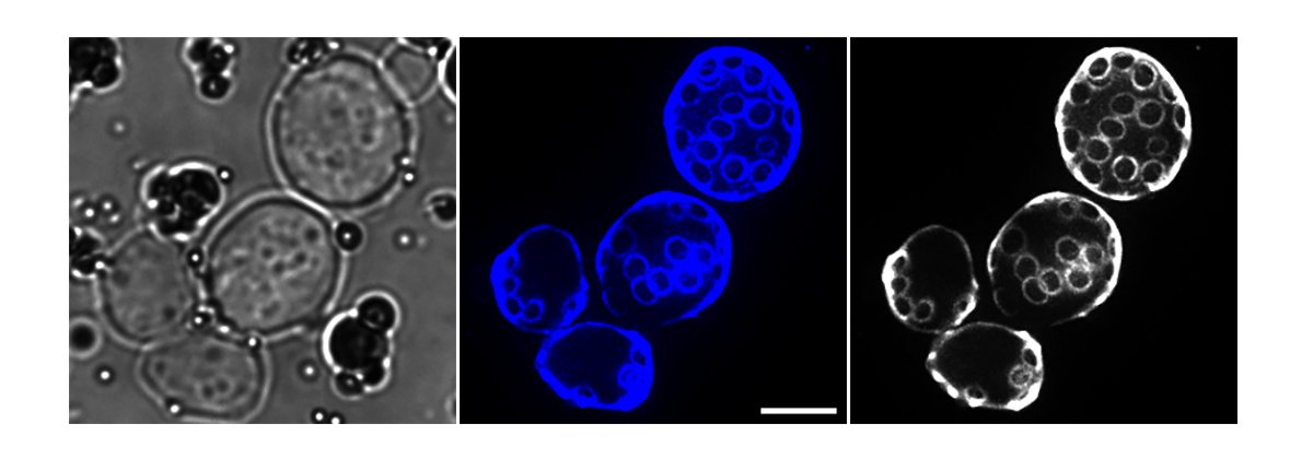 India BioImaging (@indiabioimaging) on Twitter photo 🔬 For this week’s #FluorescenceFriday, IBI presents:
"AGE IS INDEED JUST A NUMBER: BUD SCAR NUMBER" 🧫✨Yeast bud scars stained with Calcofluor White reveal replicative age — more scars, older the cell! 🧫💡
A beautiful capture from Dr. Shirisha Nagotu’s lab <a href="/IITGuwahati/">IIT Guwahati</a> , 🔬 For this week’s #FluorescenceFriday, IBI presents:
"AGE IS INDEED JUST A NUMBER: BUD SCAR NUMBER" 🧫✨Yeast bud scars stained with Calcofluor White reveal replicative age — more scars, older the cell! 🧫💡
A beautiful capture from Dr. Shirisha Nagotu’s lab <a href="/IITGuwahati/">IIT Guwahati</a> ,