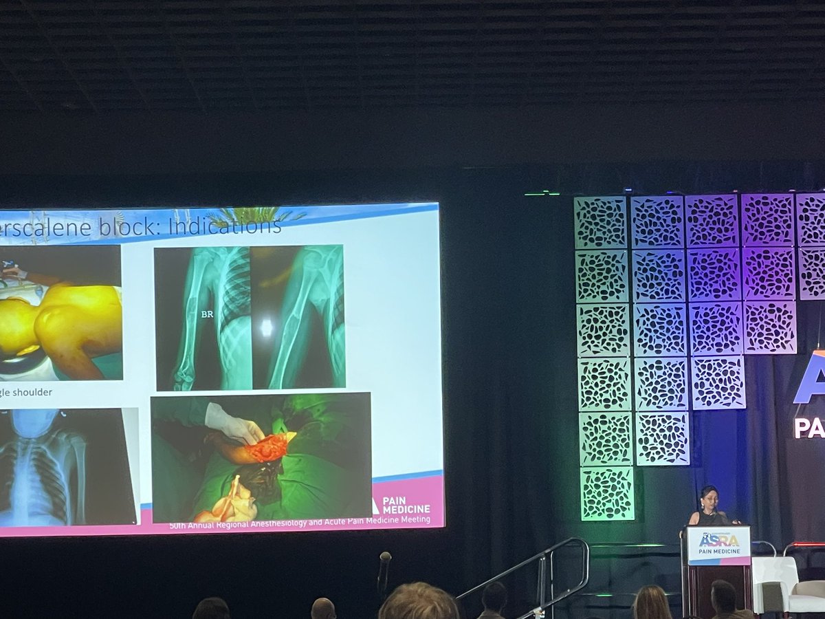 Jerry Jones (@jerryblocksthat) on Twitter photo I am SO thankful to know that this level of commitment to pediatric RA exists in the world!! KUDOS Dr Vrushali Ponde!! 👏👏👏#ASRASPRING25 I am SO thankful to know that this level of commitment to pediatric RA exists in the world!! KUDOS Dr Vrushali Ponde!! 👏👏👏#ASRASPRING25