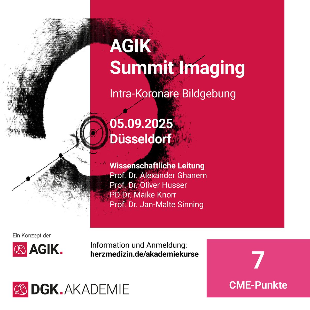 🚨 Save the Date: #AGIK Summit Imaging
🗓️ 05.09.2025 | 📍 Düsseldorf
💬 I/A Interaktiver Kurs zur intrakoronaren Bildgebung mit Fokus auf Praxisrelevanz und Fallbeispiele!

🔍 Themen-Highlights
📸 IVUS &amp; OCT: Befundoptimierung und Planung mit System
🧠 IVUS 123 u. MLD