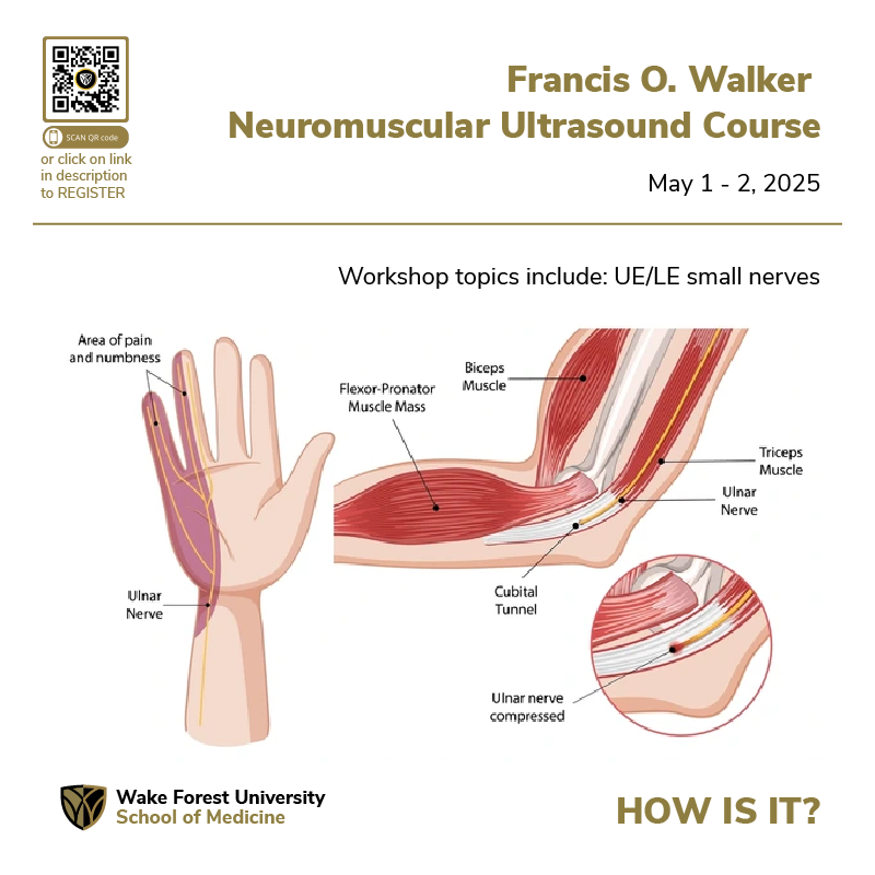 Wake Forest Ultrasound (@ultrasoundwake) on Twitter photo How is our #Neuromuscular #Ultrasound #course?
northwestahec.wakehealth.edu/t3/courses-and…
---
<a href="/AtriumHealthWFB/">Atrium Health Wake Forest Baptist</a> <a href="/UltrasoundWake/">Wake Forest Ultrasound</a> <a href="/wakeforestmed/">Wake Forest University School of Medicine</a> #onlineclass #scanning #cometrainwiththebest #healthcareexcellence #healthcare #May #virtualdidactics How is our #Neuromuscular #Ultrasound #course?
northwestahec.wakehealth.edu/t3/courses-and…
---
<a href="/AtriumHealthWFB/">Atrium Health Wake Forest Baptist</a> <a href="/UltrasoundWake/">Wake Forest Ultrasound</a> <a href="/wakeforestmed/">Wake Forest University School of Medicine</a> #onlineclass #scanning #cometrainwiththebest #healthcareexcellence #healthcare #May #virtualdidactics