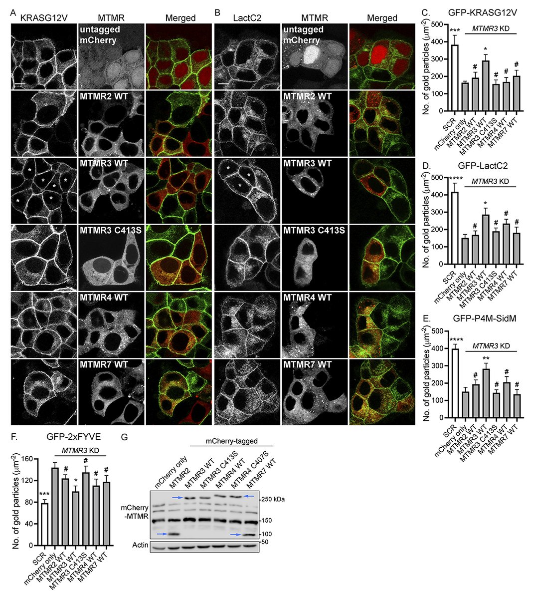 Taylor Lange, Kwang-jin Cho <a href="/wrightstate/">Wright State University (Dayton, OH)</a> and colleagues discovered that silencing the phosphatidylinositol (PI) 3-phosphatase, MTMR, disrupts the PM localization of PtdSer and KRAS. hubs.la/Q03kQWQC0 

#Cancer #Membrane #lipid #CellSignaling #Biochemistry