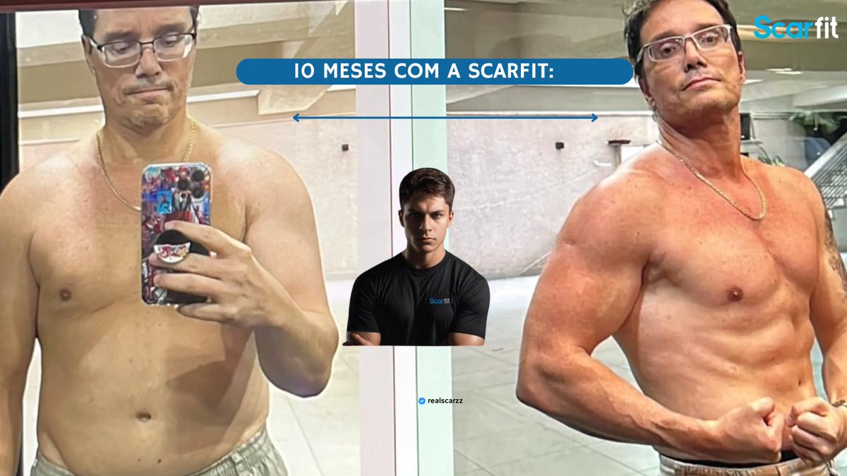 joaoscar_'s tweet image. 🚨 Você quer ter esse resultado sem erros?

Com um plano feito pra sua rotina, o resultado vem muito mais rápido:

• Nutri, Fisio &amp;amp; Personal 
• Acompanhamento diário
• Aplicativos inclusos

Fala comigo no WhatsApp, clica no link da BIO e me conta qual o desafio, te aguardo!