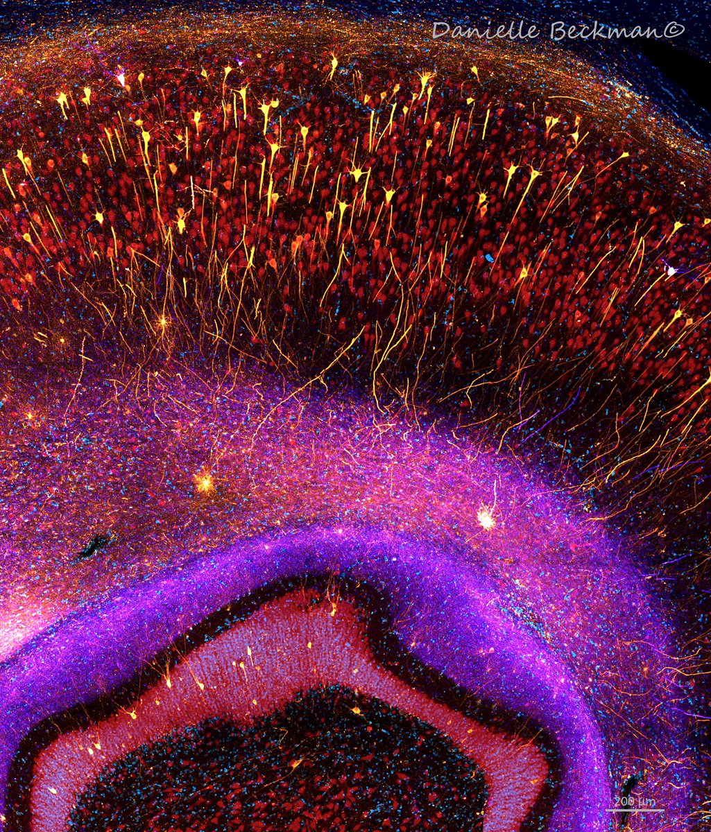 My mom used to love #FluorescenceFriday, so I will keep posting in her memory ❤️
This photo shows neurons in the hippocampus accumulating phospho-tau in our monkey model of Alzheimer's Disease. 
Markers: Dapi 🔵, Neun 🔴, pTau 422🟣, AT8🟡