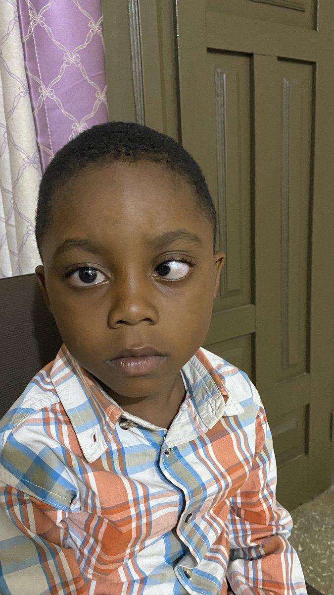 theknustgazette's tweet photo. 📍🦅   𝐉𝐔𝐒𝐓 𝐈𝐍  📍🦅

Ghanaian Doctor, Doreen Tachie-Donkor (Optometrist), Shocks the Internet!

Dr. Doreen Tachie-Donkor has amazed many by successfully treating a young boy’s Strabismus (commonly known as Alukumi)—a condition many believed was untreatable. Her incredible work has not only brought hope to many but has also skyrocketed her reputation within the health fraternity, earning the trust and admiration of Ghanaians nationwide.

Dr. Doreen is a 6th-year Doctor of Optometry student at KNUST, and formerly served as the Head of the Health Office under the 63rd SRC administration.

Her dedication, skill, and passion for eye care continue to inspire many.
Ayekoo, @dr_doreeeeenn—we are proud of you! ⭐️ ⭐️🎉 🏆 
#HappyEaster