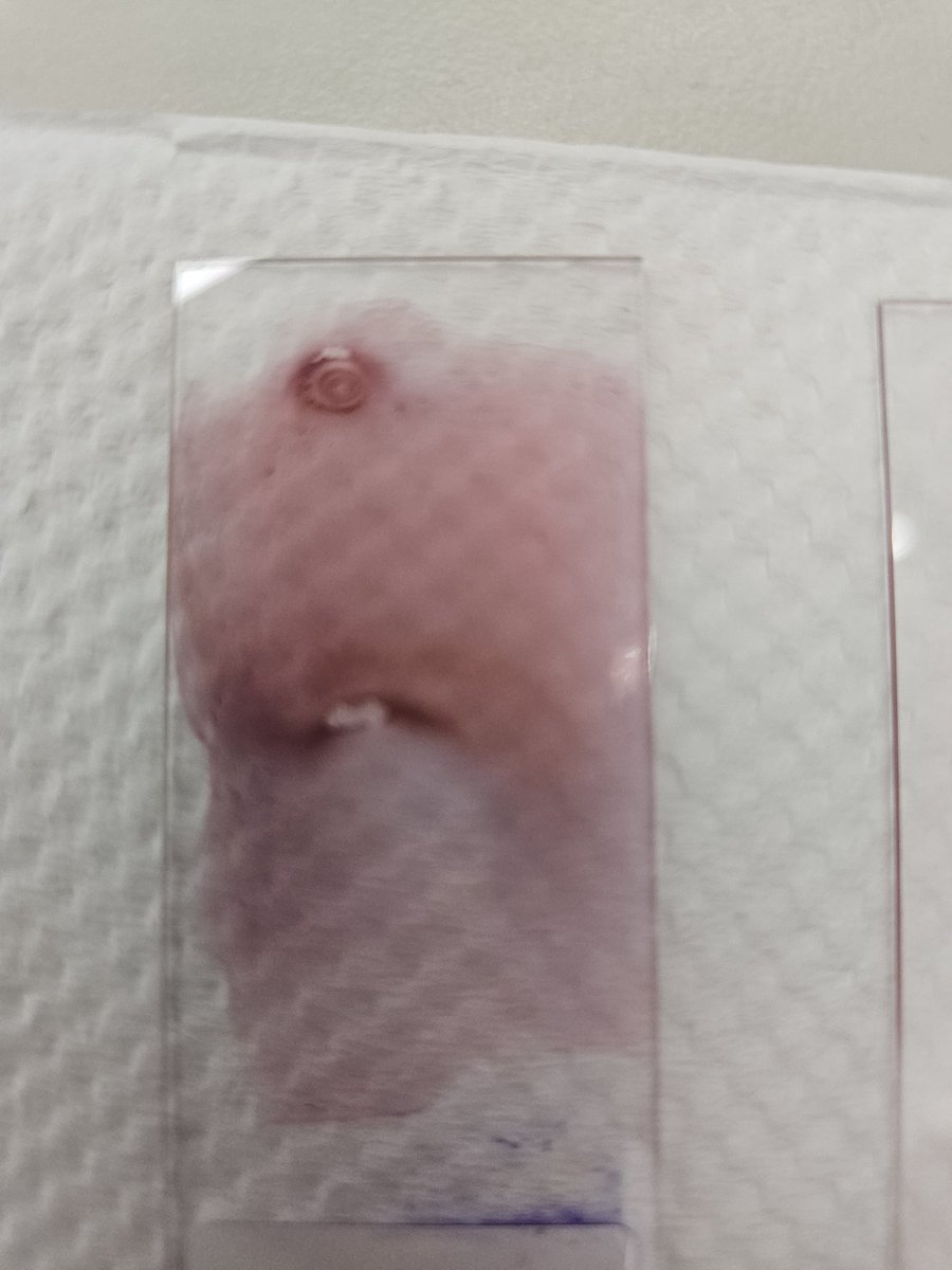 Nflann17's tweet photo. If you don't see a one-eyed, buck-toothed monster, ... What do you see??
#science #microbiology #gramstains #slide #Biology https://t.co/tOC7R7vOri