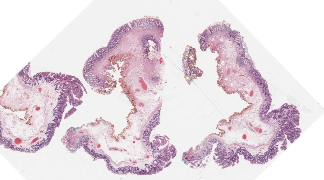 Jay "Thymocyte" Hwang tweet media