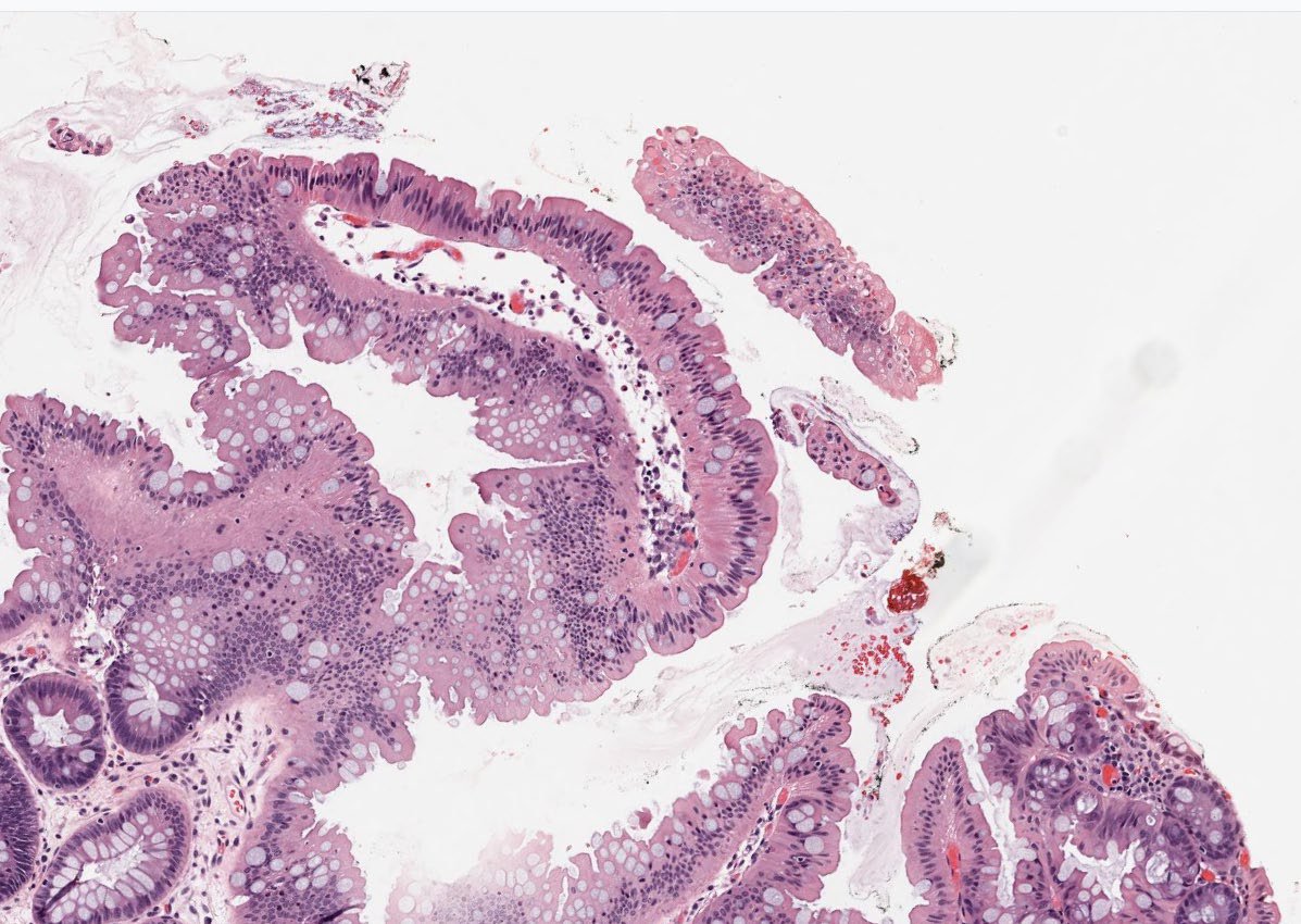 Jay "Thymocyte" Hwang tweet media