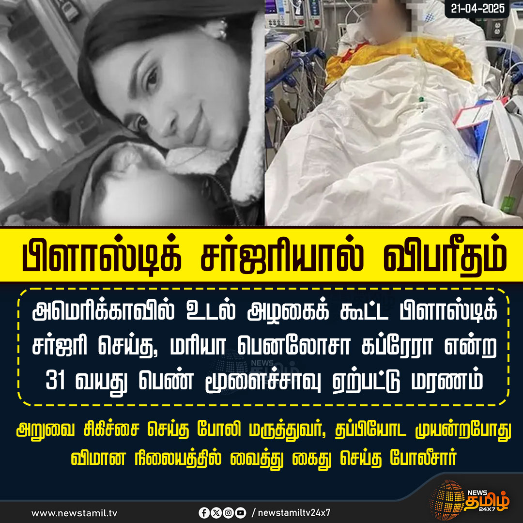 NewsTamilTV24x7's tweet image. #NewsUpdate || பிளாஸ்டிக் சர்ஜரியால் விபரீதம்

#CosmeticSurgery | #America | #US | #MariaPenalozaCabrera | #TamilNews | #NewsTamil |#NewsTamil24x7