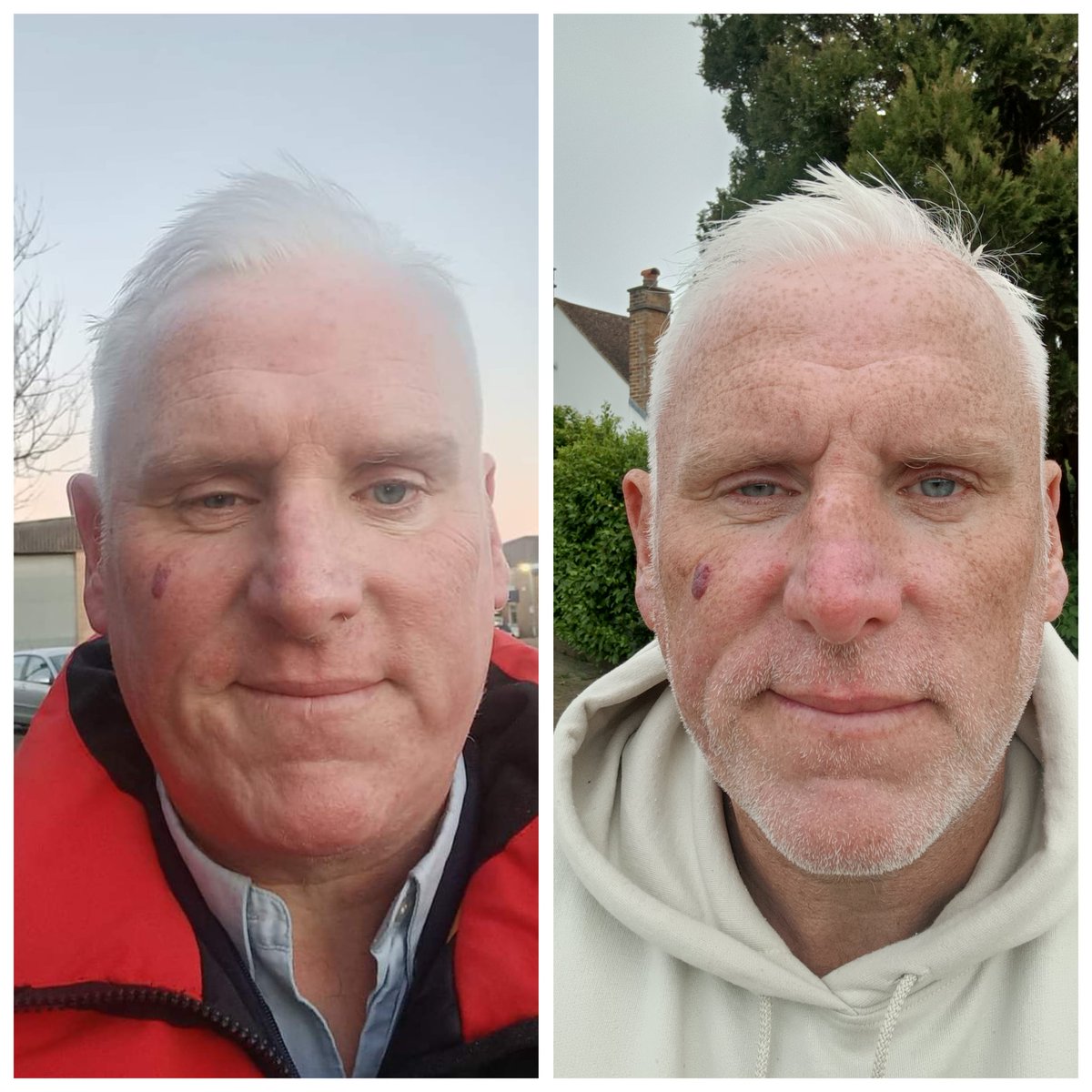 Sorry for the self appreciation post,
Left- Jan 24, struggling hugely but trying to smile
Right - Apr 25, still struggling at times but feeling stronger, 2st down and still working.

So much work put in on myself to refind who I am, 1st tattoo booked to remind me of my journey💪