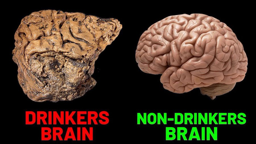 DanielRaz_Fit's tweet photo. 90% of people think drinking alcohol in moderation is healthy.

The reality is, drinking even a little bit can disrupt your fat storage, metabolism and kill brain cells.

Here’s what alcohol really does to your body: 🧵 https://t.co/fqngnywEqw