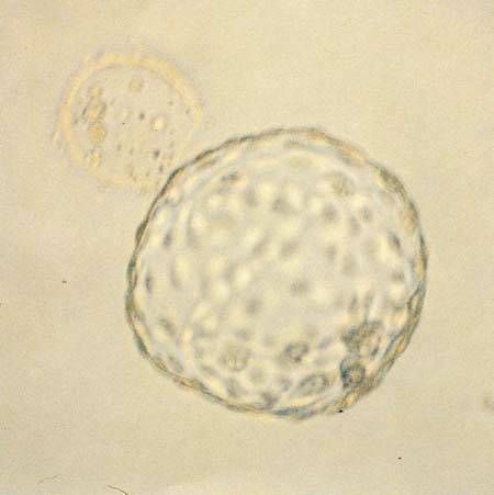 #OTD Oskar Hertwig was born in 1849. Hertwig was the first to recognise that sperm and eggs fuse to form an embryo.