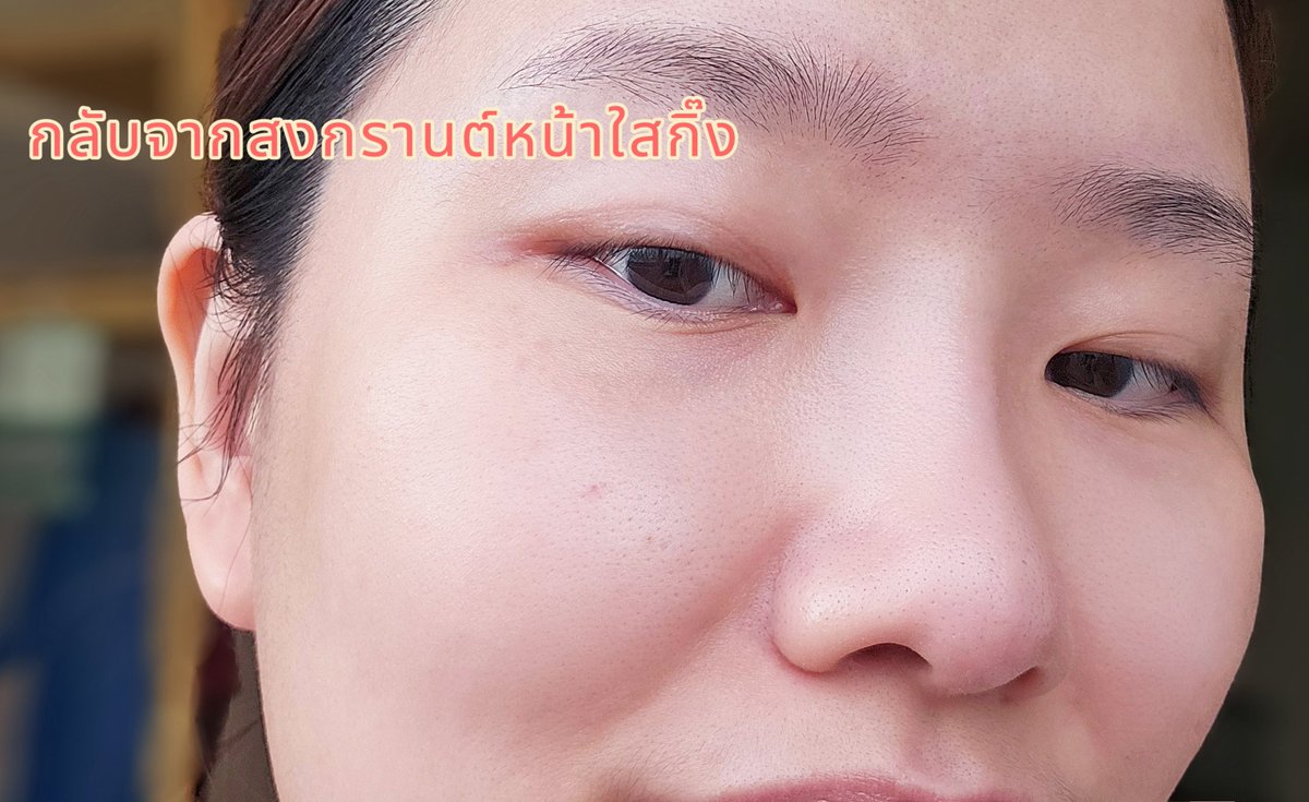 ผ่านสงกรานต์มา โดนทั้งน้ำ ความร้อน แป้ง แต่ผิวไม่เยินเลย นี่กิน zinc เป็นซิงค์ที่อร่อยมากกก Jelly Me ZinC หอมกลิ่นพีช กลิ่นง่าย เคี้ยวเพลิน ไม่มีน้ำตาล ดูแลผิวลดสิวแถมยังอร่อยอี้ก

#JellyMe #JellyMeCuti #ความคิวทิบิลด์ง่ายได้ทุกวัน #JellyMeZinc #ลดสิว #HowtoPerfect https://t.co/8j9kmsAkAm