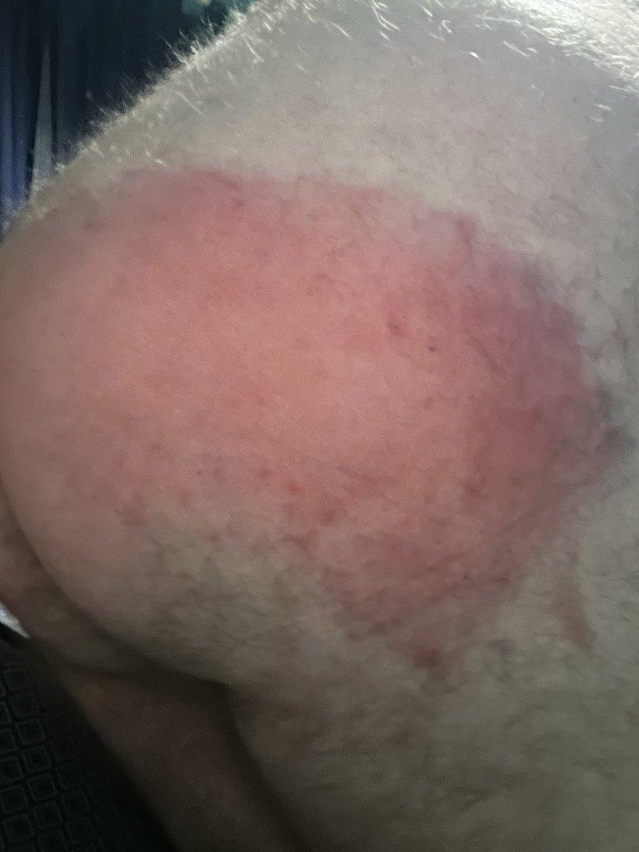 From a beating this weekend...but now looking for a top up