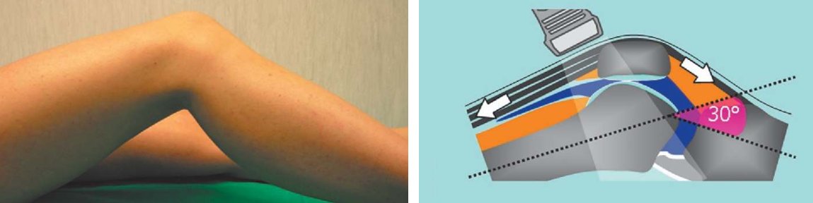 Musculoskeletal ultrasound: technical guidelines
Edited by The Ultrasound Subcommittee of the
European Society of Musculoskeletal Radiology (ESSR)

FREE PDF
Link: 
scispace.com/pdf/musculoske…