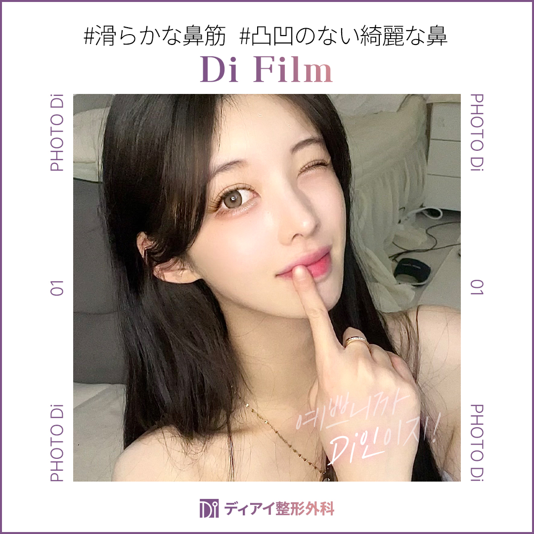 diprsjp's tweet photo. 皆さんが最も気にする顔の部位は何ですか？☺
目や口も大事ですが、鼻が顔の中心を取ってくれると思っている方が多いです。
鼻の形によって印象が大きく変わったりします~！🤓

わし鼻は、鼻の甲が曲がって老けて見えたり、強い印象を与えることがあります。 🤔
韓国では鷹のくちばしのように見えるということで、メブリコの意味でメブリコと呼んでいます。
多くの方が鷲鼻手術で改善したがっています。 🙏🏻🙏🏻

鼻の手術を希望しながら、自然に改善したいという方がいます。
個人の鼻の形と状態によって異なる場合があります。💝
鼻の仕組みを理解し、適切な方法を選択することが重要です。
鼻の形を改善するさまざまな方法が存在し、状態に応じて適切な選択が必要です。🔆🔆

鷲鼻整形は、単に外見だけを改善する手術ではありません。😁
鼻の内部構造と機能的な要素まで一緒に考慮して進行しなければならない高難度の手術です。
鼻の中の構造のねじれにより比重格が曲がっている場合には鼻炎や呼吸の不便を感じることがあり
睡眠の質にも影響を与えることができました。 🙂

特に呼吸が円滑でない場合、慢性的な疲労感や
集中力の低下につながりかねないため、単に美容的な
理由だけでなく、機能的変化のためにも管理を考慮する必要があります。

それでは重要なことは何でしょうか？😎🩷
-診断および計画樹立
-折骨術による矯正
-鼻中隔延長術並行
-鼻の内部機能を改善

病院を選ぶ時は、単に価格や広告だけで決めるのではなく
医療スタッフの経験と実力を几帳面に確認しなければなりません。 🫡🫡
3D-CT撮影を通じて精密な診断と計画を立てる病院を選択することをお勧めします。
また、手術前の相談を通じて医療スタッフと十分にコミュニケーションを図り
自分の顔に最適なデザインを決めることが大切なこと、忘れないでください！🤗🤗

@574lbeop https://t.co/YpKlZ5bLE2 

#韓国整形外科 #韓国鼻整形 #韓国整形 #韓国鼻手術 #韓国整形情報 #韓国整形症例 #鼻整形症例 #韓国鼻整形症例 #鼻フル #団子鼻 #短い鼻 #自己肋軟骨 #鼻肋軟骨 #肋軟骨手術 #鼻手術 #鼻整形 #鼻再手術 #ハンプ手術 #ハンプ鼻 #ハンプ鼻手術 #鼻整形 #韓国鼻整形 #プロテーゼ #鼻中隔延長 #韓国鼻整形おすすめ #韓国整形外科おすすめ #韓国整形外科 #DI整形外科