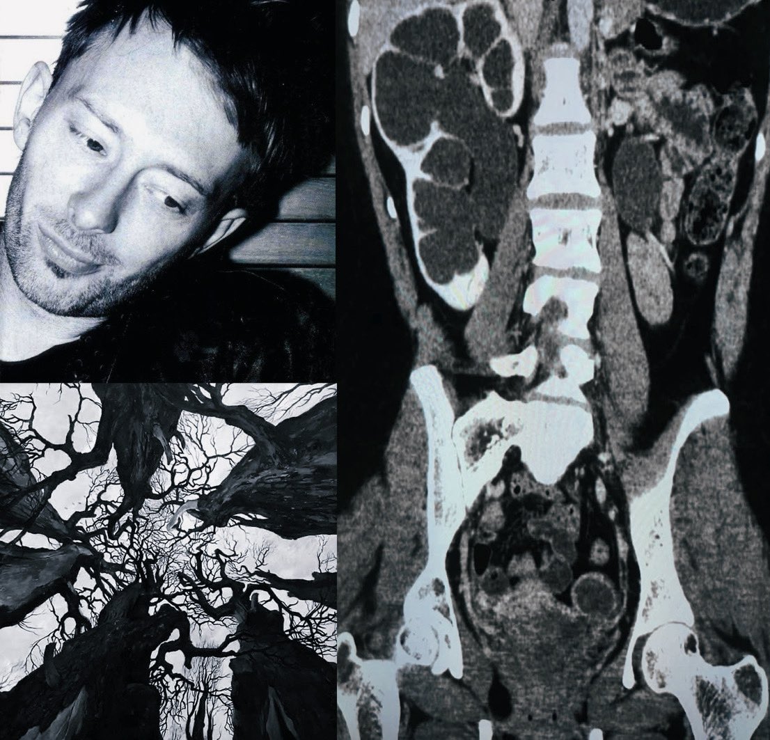 killedage32 (@greenmaybeblue) on Twitter photo 