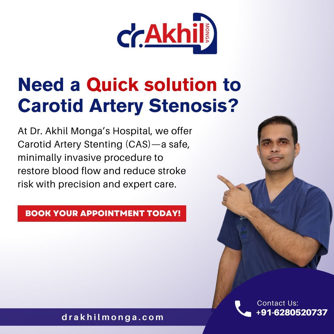 Quick solution for Carotid Artery Stenosis! Carotid Artery Stenting (CAS) restores blood flow and reduces stroke risk with precision and safety.Schedule your consultation today!
📞 +91-6280520737 🌐 drakhilmonga.com

#DrAkhilMonga#CarotidArteryStenting #StrokePrevention