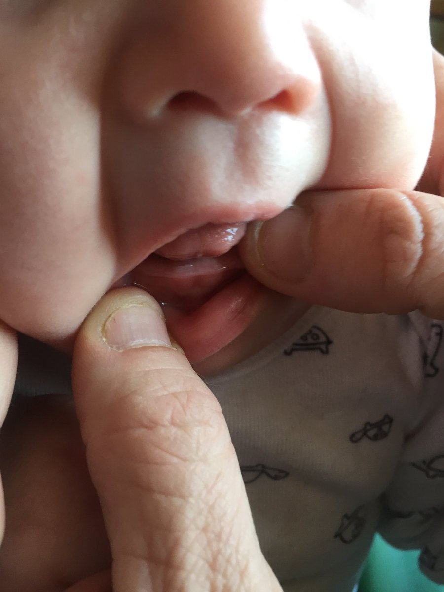 BECKYBROOKS17's tweet photo. #x #highlight #mybabyboy #ourbabyboy @jason_naves  @BECKYBROOKS17 #ourheart #ourprideandjoy #TheLastOfUs  #preciousmoments #boyswillbeboys #boybuilttough #timeisathief #wherehasthetimegone #reno #nevada #home #homeiswheretheheartis #viral #hesavedusboth #firsttooth #onedayatatime https://t.co/UIqwW42rPm