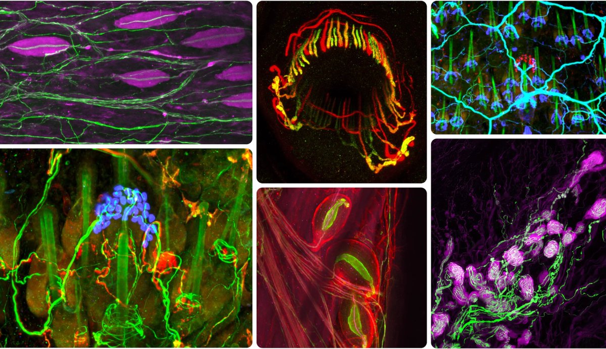 The neurons beneath everyday sensations.

"How does pressure and vibration across millions of nerve endings become a hug?"

"Of all the senses, the somatosensory system is the most complex, and therefore touch, some researchers argue, is the most difficult to study."

#Science
