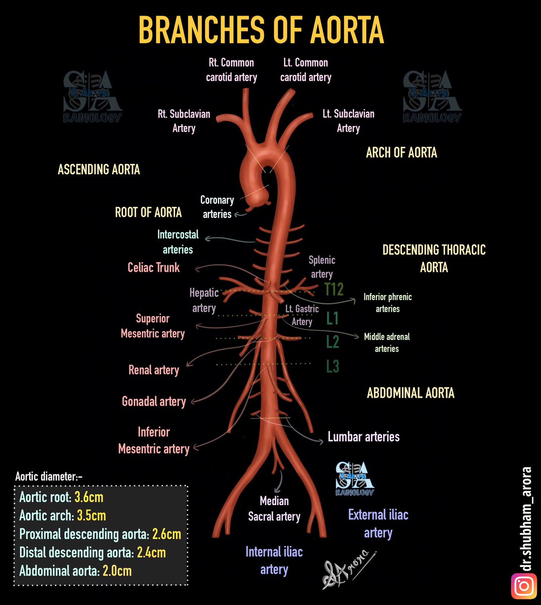 Dr_S_Arora's tweet image. Slide on branches of aorta
#radiology #medx #illustration