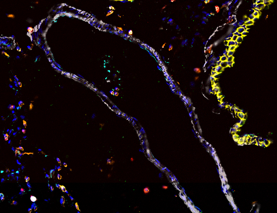 Science Immunology (@sciimmunology) on Twitter photo Scientists have identified lung #endothelial cells as sources of TGFβ1 that guide the development and function of lung #InterstitialMacrophages in mice. <a href="/GIGA_ULiege/">GIGA-ULiège</a> <a href="/UniversiteLiege/">Université de Liège</a>
Read more in Science #Immunology: scim.ag/3Enz9LF Scientists have identified lung #endothelial cells as sources of TGFβ1 that guide the development and function of lung #InterstitialMacrophages in mice. <a href="/GIGA_ULiege/">GIGA-ULiège</a> <a href="/UniversiteLiege/">Université de Liège</a>
Read more in Science #Immunology: scim.ag/3Enz9LF