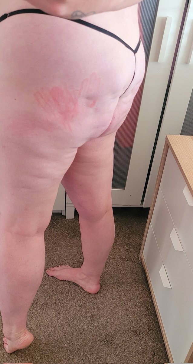 MrsS65821351's tweet photo. I'd say hubby got a bit horny wouldn't you? ๐
#spankedarse #lefthismark https://t.co/deej9C6Hl0