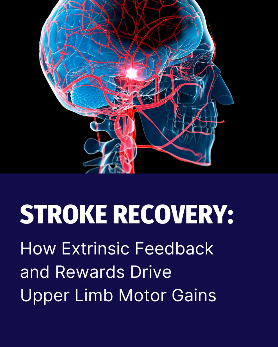 🧠 How does extrinsic feedback shape stroke recovery?⁠

🔗 app.physiotutors.com/research-revie…
⁠
#stroke #neurorehab #motorlearning #rehabscience #feedbacktraining #physiotherapy #physicaltherapy #evidencebased #rehab #physiotutors #neuroplasticity