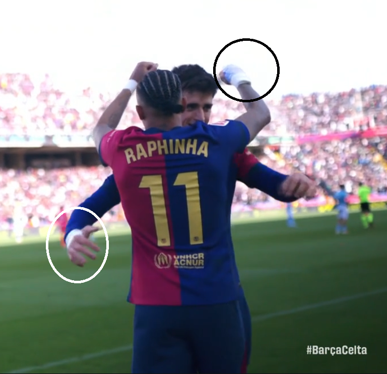 DonShelby__'s tweet photo. Vamos hablar de Pau Víctor

- ha jugado 47 minutos en 2025
- lleva la mano con un vendaje igual que Raphinha, Lewandowski, Lamine Yamal, Gavi y De Jong

Pero de qué cojones puede tener la mano lesionado, ¿de hacerse una paja? https://t.co/hMKALRphq7