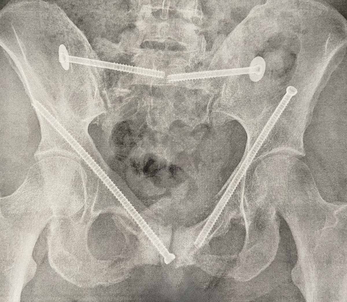 Erin Cooke, MD tweet media