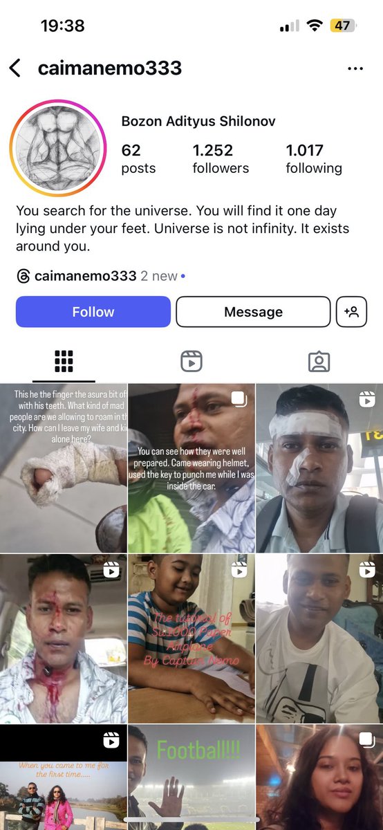 Brahm_AI's tweet image. The Pride of IAF 
Shilajit BSDK 
Who takes Shilajit &amp;amp; beats PPL on road &amp;amp; then gets beaten back by an untrained innocent civilian trying to defend himself,
Then cries like a little Bitch to his defence community, who propagate his lies as Gospel truth. 
#ArrestWingCommander