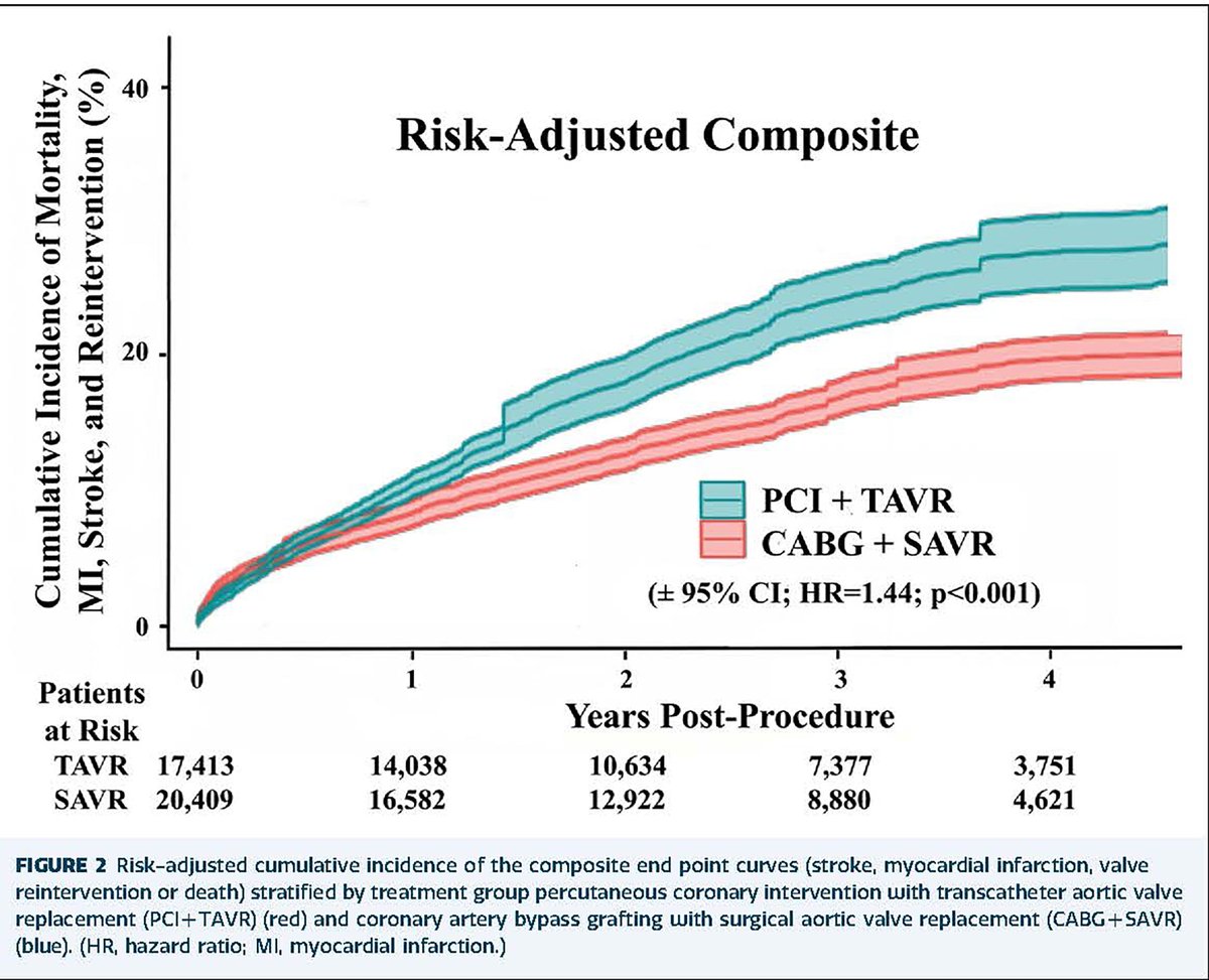 The Annals of Thoracic Surgery (@annalsthorsurg) on Twitter photo #AdultCardiac #CME article from <a href="/vikjag45/">Vikrant Jagadeesan, MD</a> et al on Transcatheter vs Surgical Aortic Valve Replacement in Medicare Beneficiaries With Aortic Stenosis and Coronary Artery Disease: doi.org/10.1016/j.atho… #AnnalsCME
<a href="/hunter_mehaffey/">J. Hunter Mehaffey</a> <a href="/AworiHayanga/">J. W. Awori Hayanga MD</a> <a href="/RameshDaggubati/">Ramesh Daggubati</a> <a href="/BadhwarVinay/">Vinay Badhwar</a> #AdultCardiac #CME article from <a href="/vikjag45/">Vikrant Jagadeesan, MD</a> et al on Transcatheter vs Surgical Aortic Valve Replacement in Medicare Beneficiaries With Aortic Stenosis and Coronary Artery Disease: doi.org/10.1016/j.atho… #AnnalsCME
<a href="/hunter_mehaffey/">J. Hunter Mehaffey</a> <a href="/AworiHayanga/">J. W. Awori Hayanga MD</a> <a href="/RameshDaggubati/">Ramesh Daggubati</a> <a href="/BadhwarVinay/">Vinay Badhwar</a>