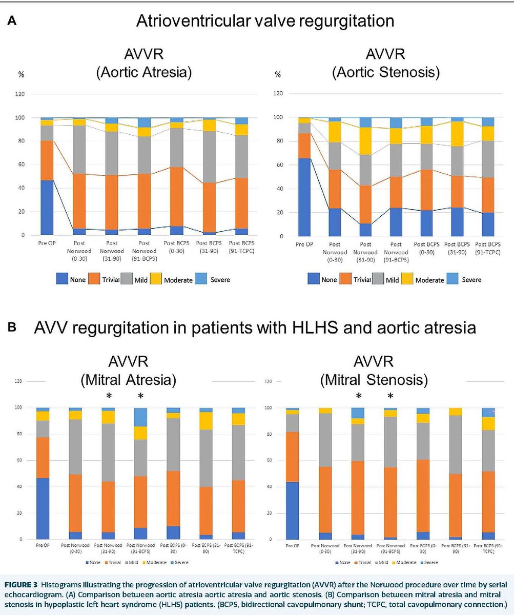 #Congenital #CME article from Fetcu et al on Impact of Atretic Aortic Valve on Systemic Ventricular Function After the Norwood Procedure: doi.org/10.1016/j.atho… #AnnalsCME