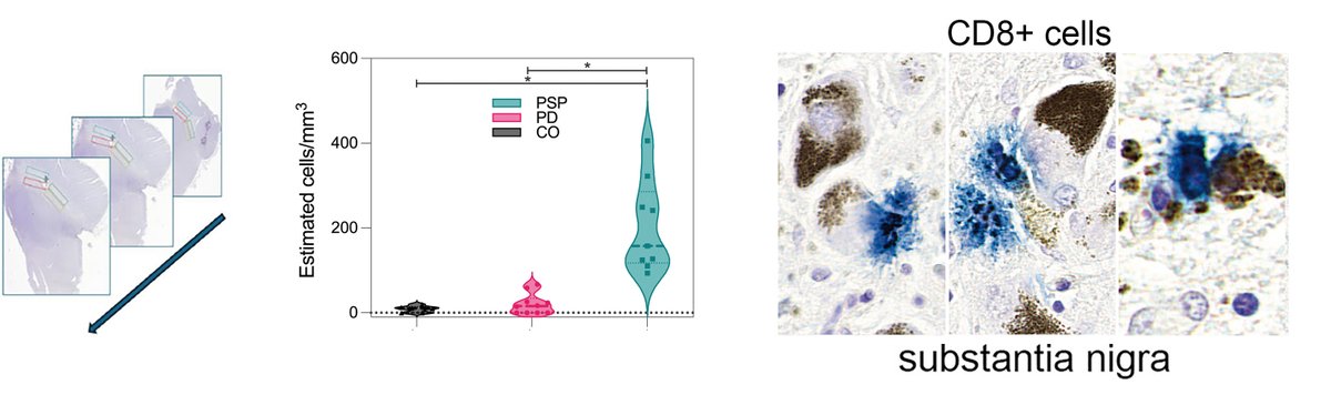 Couto et al. observe increased numbers of cytotoxic T cells in the substantia nigra of patients with progressive supranuclear palsy compared to Parkinson’s disease, suggesting a potential autoimmune component in the pathogenesis of PSP. tinyurl.com/4k8vm2h9