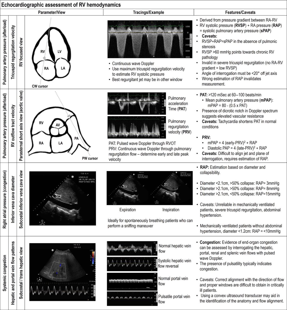 Assessment of RV hemodynamics
#POCUS