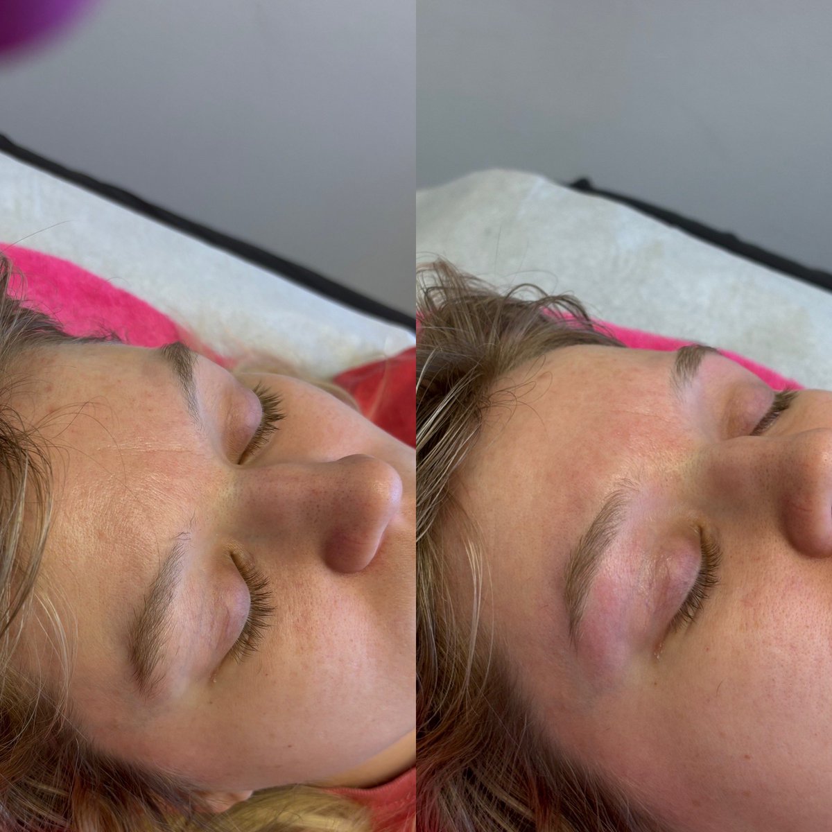 BriannaAkeira's tweet image. Eyebrow wax 🥰 #browporn #rvawaxer #brows #esthetician
