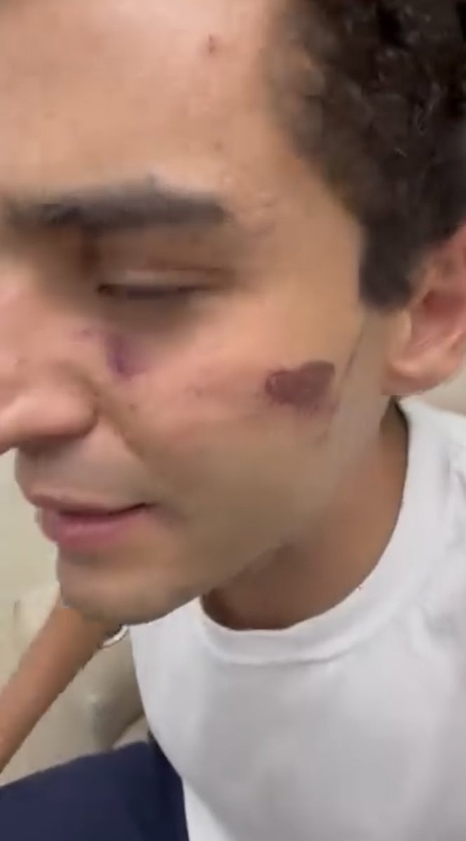 c4jimenez's tweet photo. LLEGÓ ILESO al TORITO
Es Juan Pablo Glz en la puerta del Torito.
Agentes de @SSC_CDMX lo llevaron tras agredir a una trabajadora de @AlcaldiaMHmx e insultar y llamar PERRA a una mujer policía.
No tiene ni un rasguño.
Pero según él, los policías le dieron de palazos y patadas. https://t.co/kZozTrAXjD