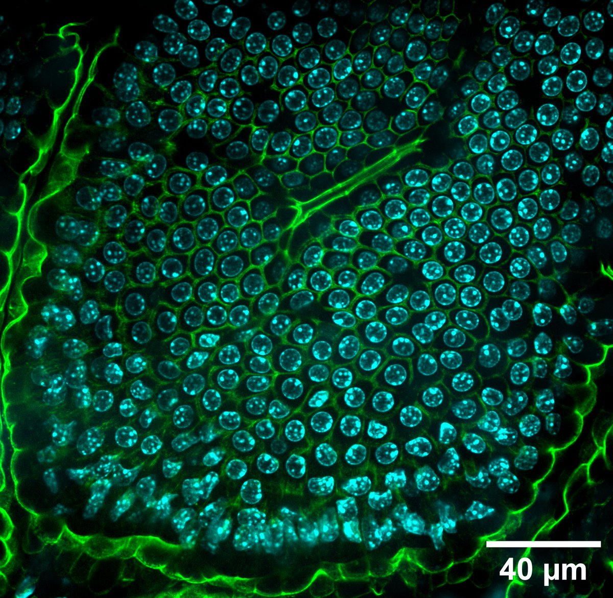 Happy #MicroscopyMonday!

Bees didn’t invent the honeycomb—biology’s been doing it at the single-cell level all along.

🟢 GFP-tagged junctions
🔵 Hoechst-stained nuclei

A living mouse intestinal villus.

No blueprint. Just (bio)physics.

#intravitalimaging #cellbiology #OME