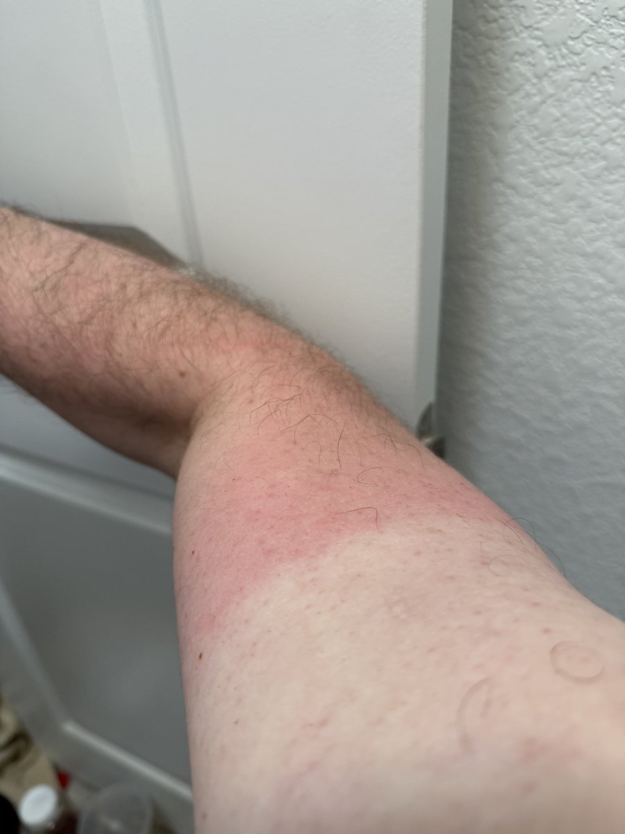 touch grass they said