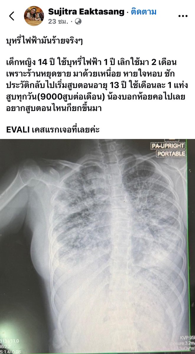 .ม่วนใจ๋ ❤️ tweet media