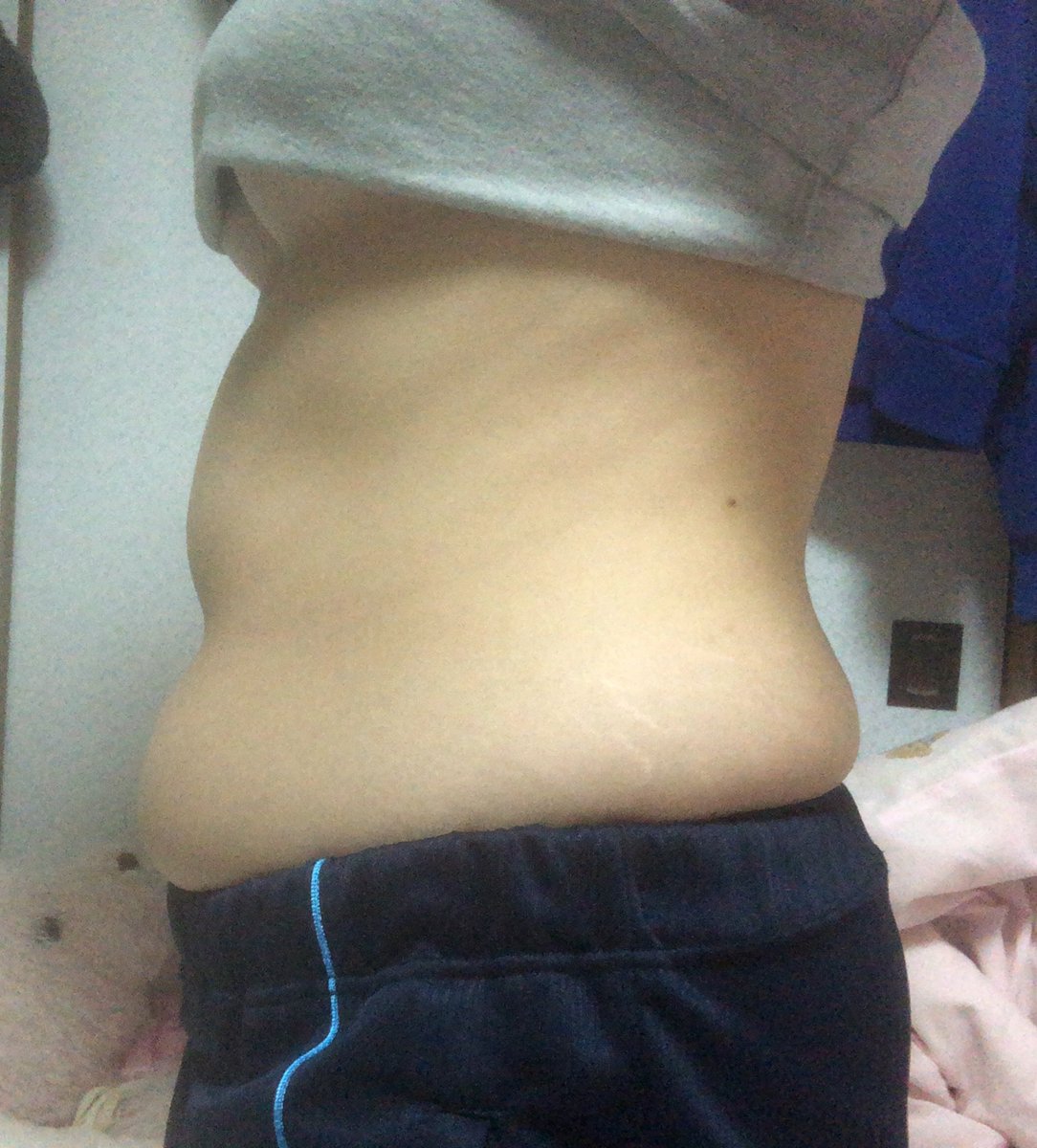 病院の先生に太り過ぎだと言われてしまった…流石に痩せなきゃな（ ;  ; ）
前まであった隙間やくびれがなくなった😂投稿していけば痩せる気になれるかな？笑