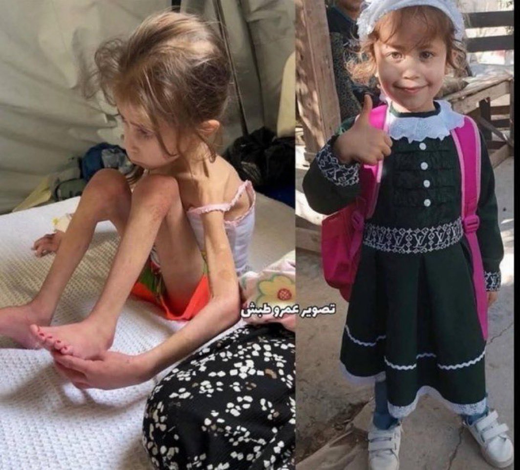 #Gazze'de çocuklar açlıktan ölüyor. Bilerek. Planlanarak.