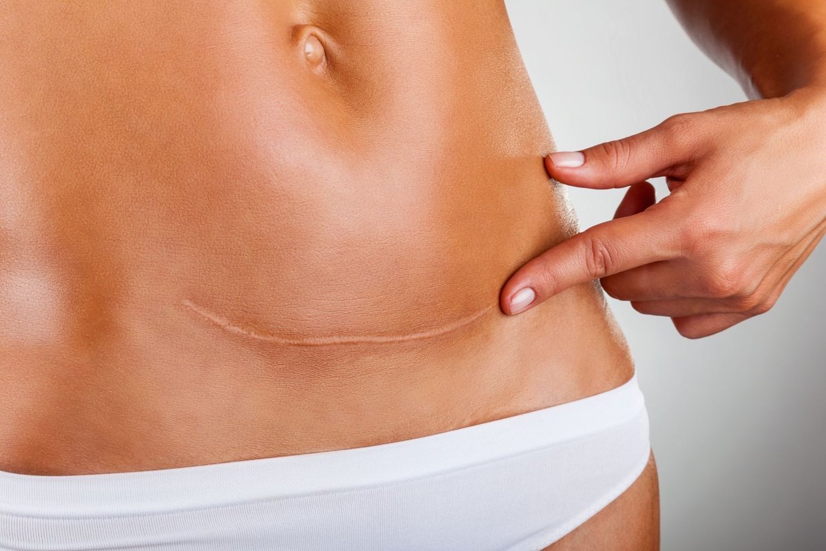 CerfiaFR's tweet image. 🇹🇷👶 FLASH | La Turquie a interdit les accouchements par césarienne sans justification médicale dans les établissements de santé privés, le pays ayant le plus de césariennes dans l'OCDE. Le président Erdogan souhaite que les femmes accouchent par voie basse "classique".