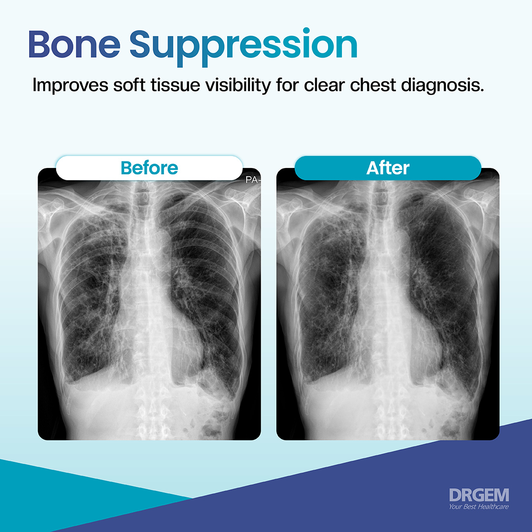 drgemhealthcare's tweet photo. Why DRGEM?
We develop our own software
—and lead the way in high-quality imaging.
From image acquisition to AI-based diagnostic assistance, RADMAX delivers efficient workflow and superior image clarity.
#WhyDRGEM #ThinkDRGEM #RADMAX #DigitalImagingSoftware #AIDiagnostics https://t.co/rHrg1NdVA5