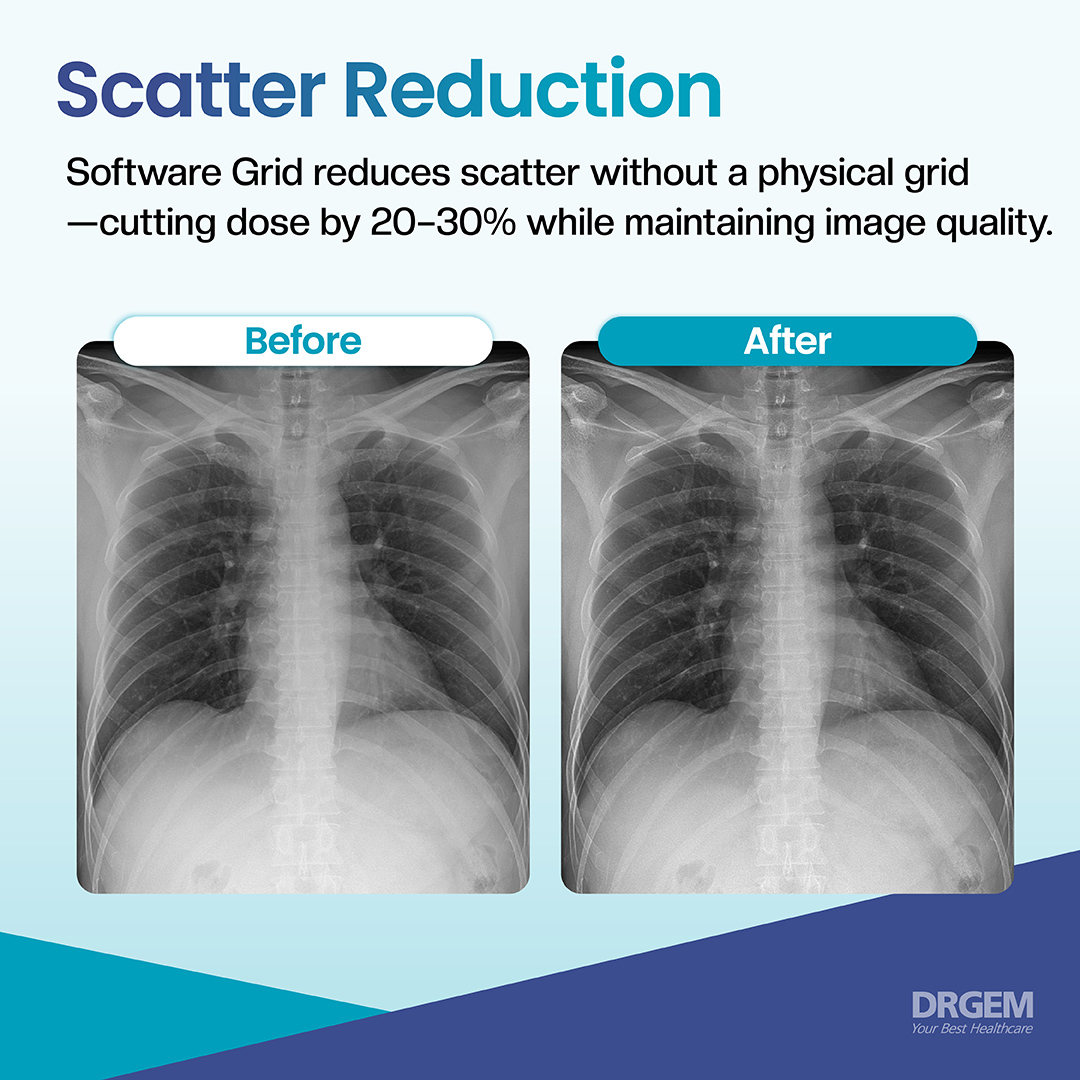drgemhealthcare's tweet photo. Why DRGEM?
We develop our own software
—and lead the way in high-quality imaging.
From image acquisition to AI-based diagnostic assistance, RADMAX delivers efficient workflow and superior image clarity.
#WhyDRGEM #ThinkDRGEM #RADMAX #DigitalImagingSoftware #AIDiagnostics https://t.co/rHrg1NdVA5
